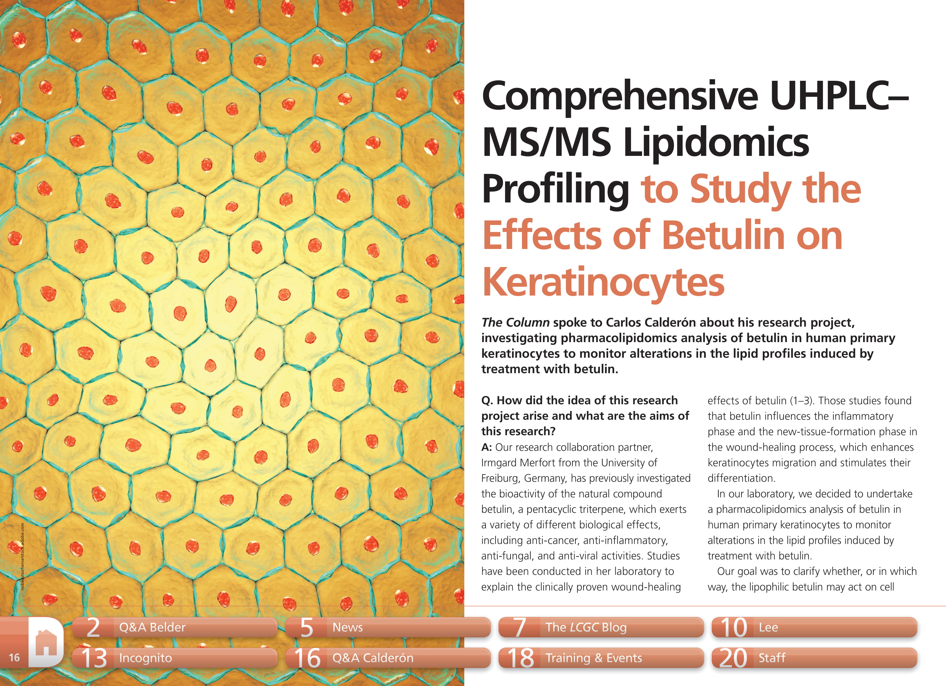Comprehensive UHPLC–MS/MS Lipidomics Profiling to Study the Effects of Betulin on Keratinocytes 